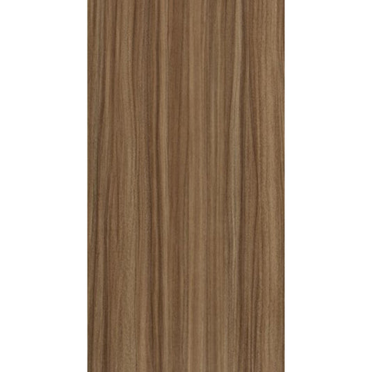 0.8 mm Sunmica - AICA laminates by " IFI - Trusted Interior Materials product store" at Karnataka Bangalore. Laminates near me 5403 Deco Walnut Laminate. Offers best price at wholesale rate. Building Material Supply, Home Interior Depot, Euro Pratik, Gala, Khidkihomes, Youcraft, Frikly, IBO. Latest Laminate designs. Laminates in Bangalore. Laminates at Best Price. Sunmica - AICA laminates in Bengaluru. Sunmica - AICA 0.8 mm Laminates. Sunmica - AICA laminates near me.